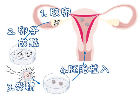 代生男孩价格